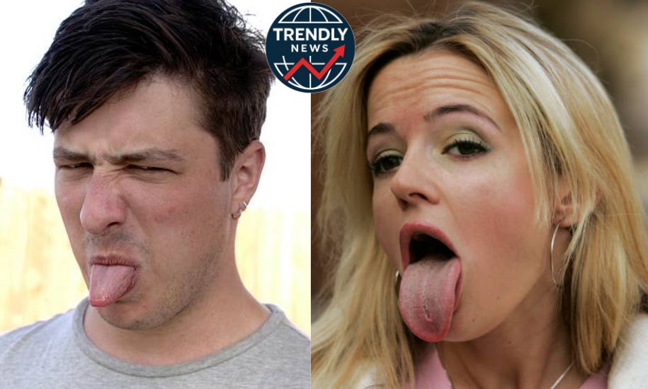 Black Spots on Tongue