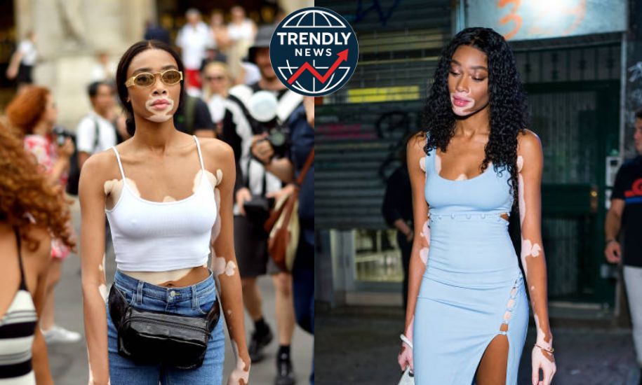 Vitiligo Sun Protection